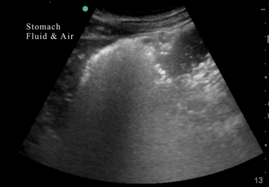 EEU case image missing